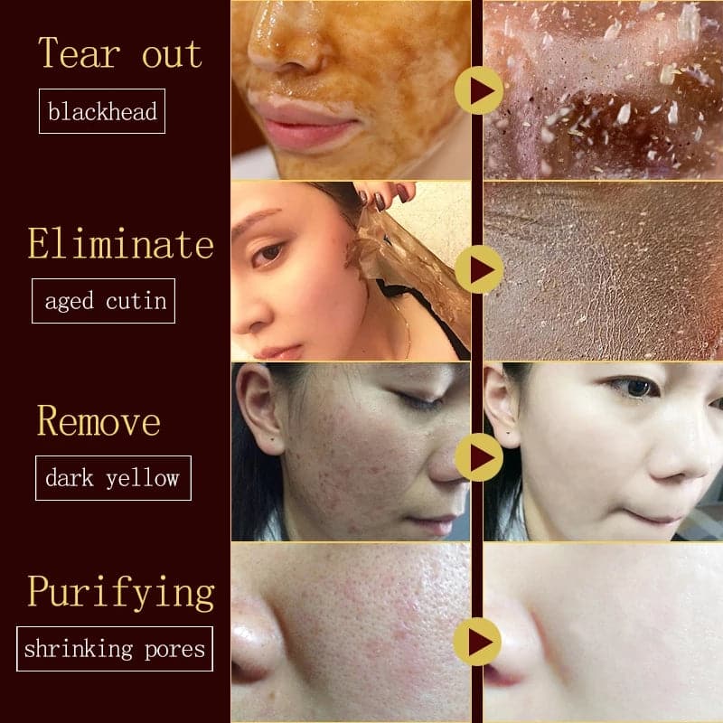 2023 TikTok Viral Honey Peeling Mask