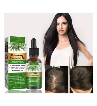 Rosemary Radiance™-Rosemary Anti-frizz Hair Growth Oil (30ml)